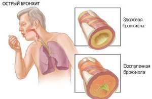 Функциональные исследования дыхания